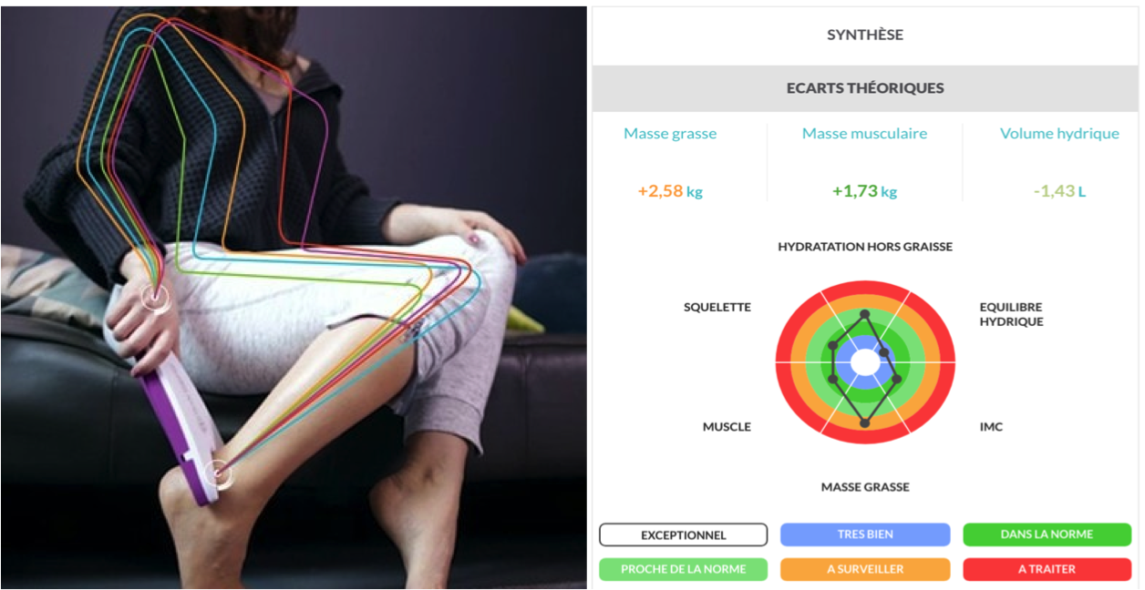 Faites un bilan corporel (gratuit) grâce à la bio-impédancemétrie